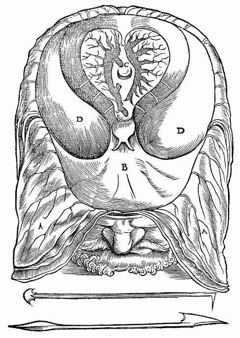Ханс Бальдунг. Иллюстрация к "Анатомии" Вальтера Херманна Риффа, Мужская голова с изображением полости малого мозга; внизу два хирургических ин