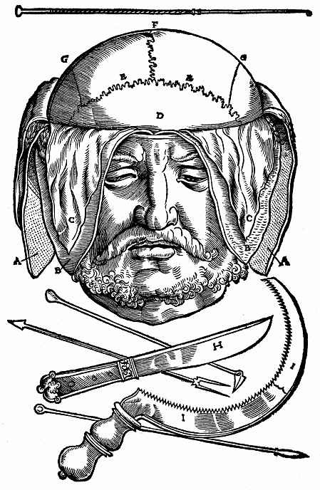 Ханс Бальдунг. Мужская голова со скальпированным черепом