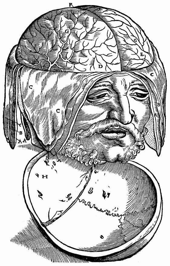 Ханс Бальдунг. Мужская голова с обнаженным головным мозгом